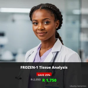 FROZEN-1 Tissue Test ZAR 1